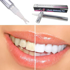 On-the-Go Brilliance: Instant Teeth Whitening Pen for a Dazzling Smile